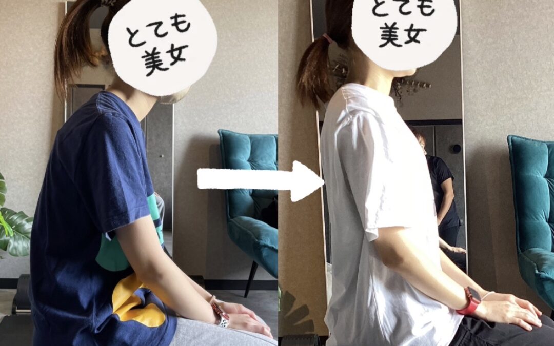 仕事を休むほどの腰痛に悩まされていた、30代の栄養士のお客様。