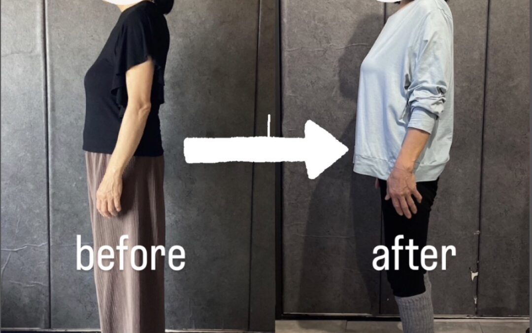 膝の痛みが取れず、いくつもの病院を回ったけれど改善しなかった。 「もう歳だから仕方ない」と、一度は諦めかけていた70代のお客様です