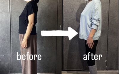 膝の痛みが取れず、いくつもの病院を回ったけれど改善しなかった。 「もう歳だから仕方ない」と、一度は諦めかけていた70代のお客様です