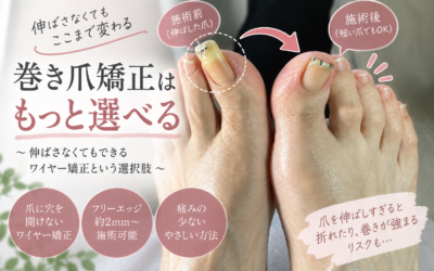 「伸ばさないと矯正できない」と言われたけど本当？